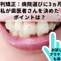 40代からの歯列矯正#4：病院選びに3ヵ月!私が歯医者を決めたポイントは?